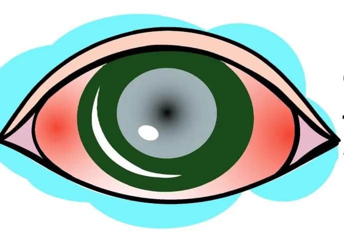 Czego nie wolno robić przy jaskrze, aby uniknąć poważnych problemów