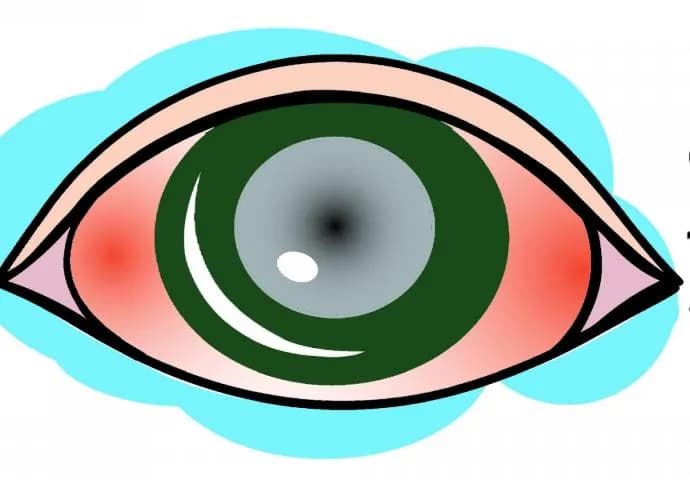 Czego nie wolno robić przy jaskrze, aby uniknąć poważnych problemów