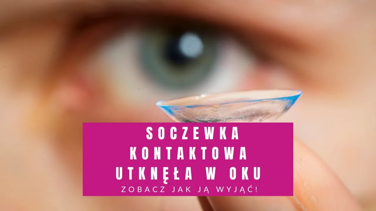 Co zrobić jak soczewka utknie w oku - skuteczne metody usunięcia