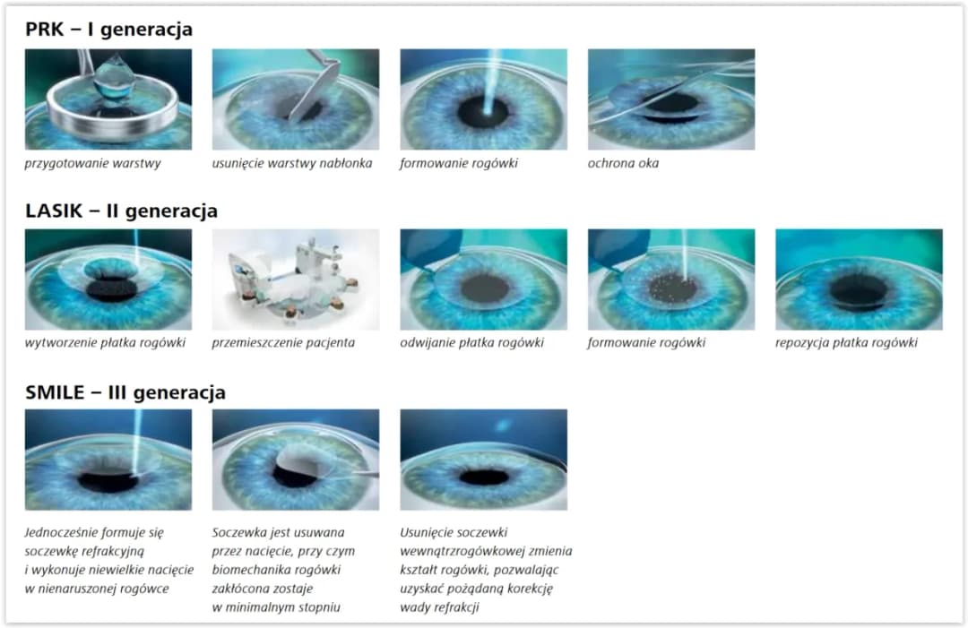 Objawy uszkodzenia wzroku laserem - poznaj sygnały alarmowe i skutki