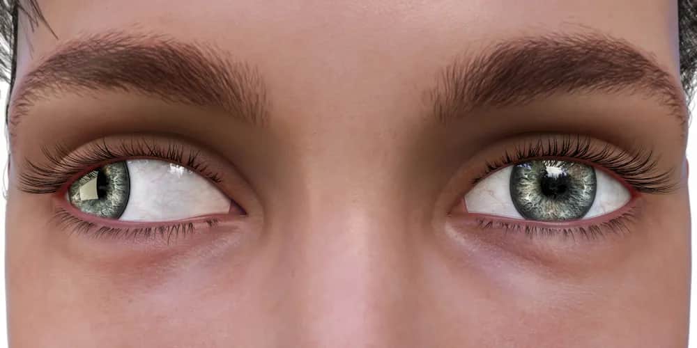 Zez porażenny objawy – jak je rozpoznać i co oznaczają dla zdrowia